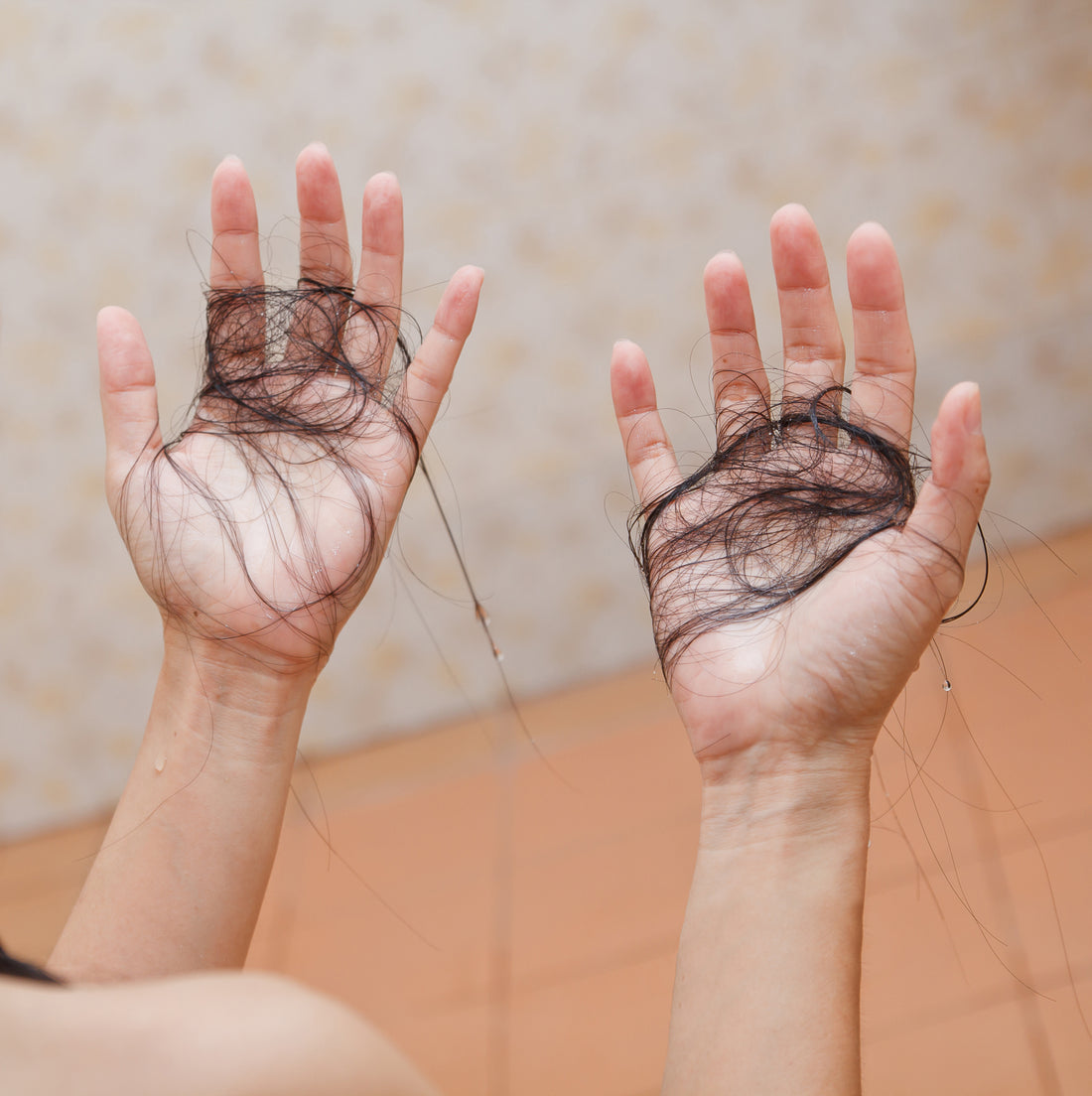 Covid & Hair Loss Due To Illness